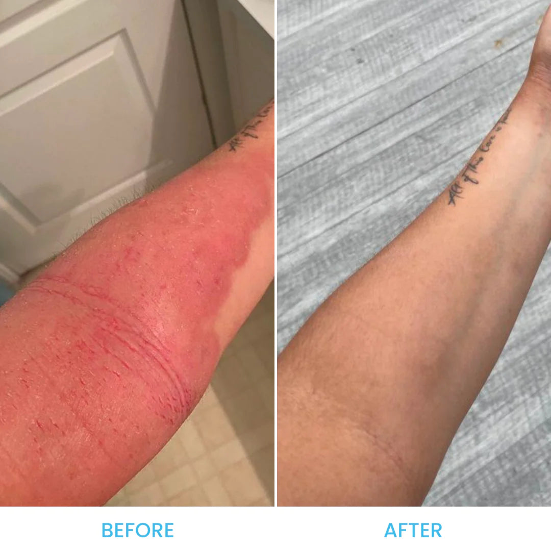 Eczema Trial Pack