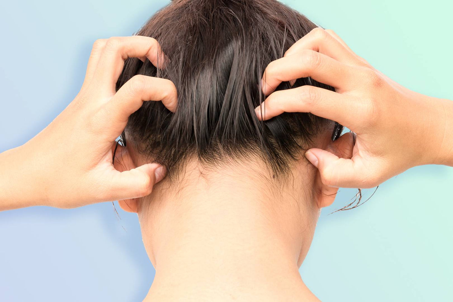 Helpful Tips For Living With Scalp Psoriasis