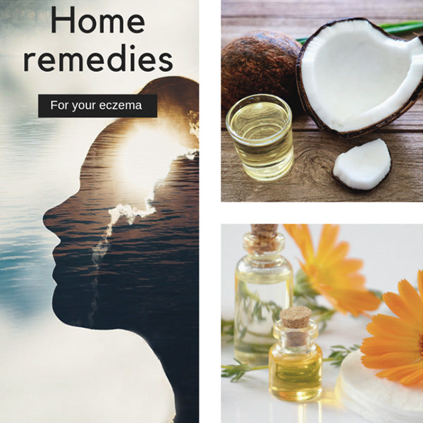 Natural Home Remedies to Help Soothe Eczema