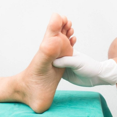 Diabetic Foot Syndrome- Treatment & Prevention