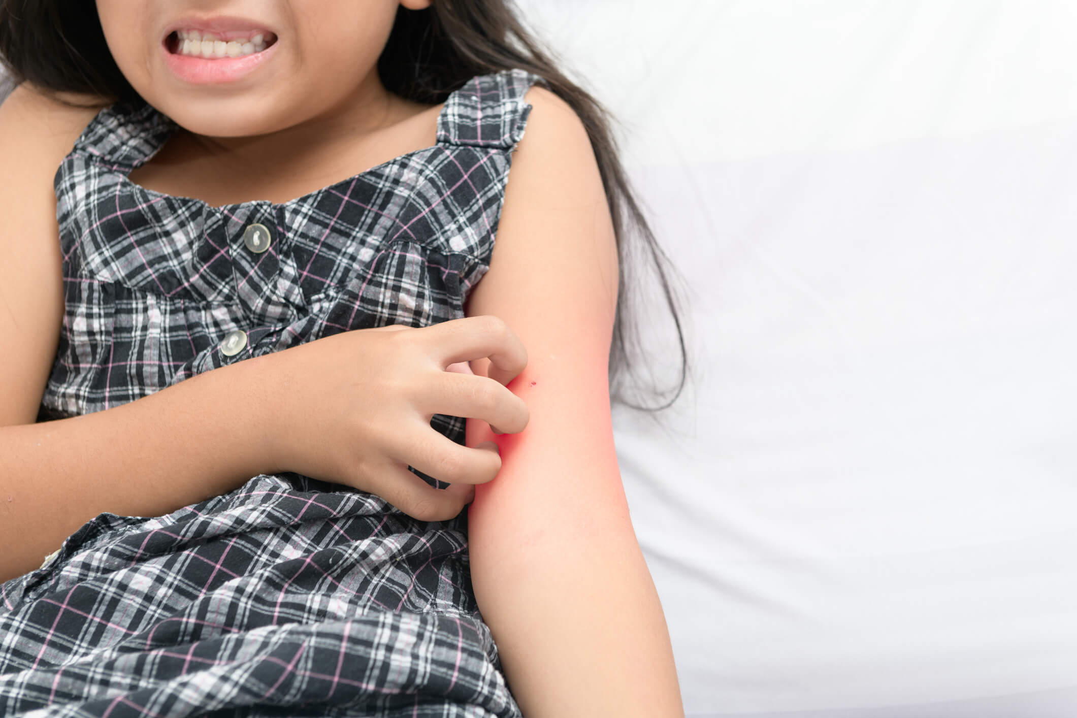 Five Tips for Raising Confident Kids with Eczema