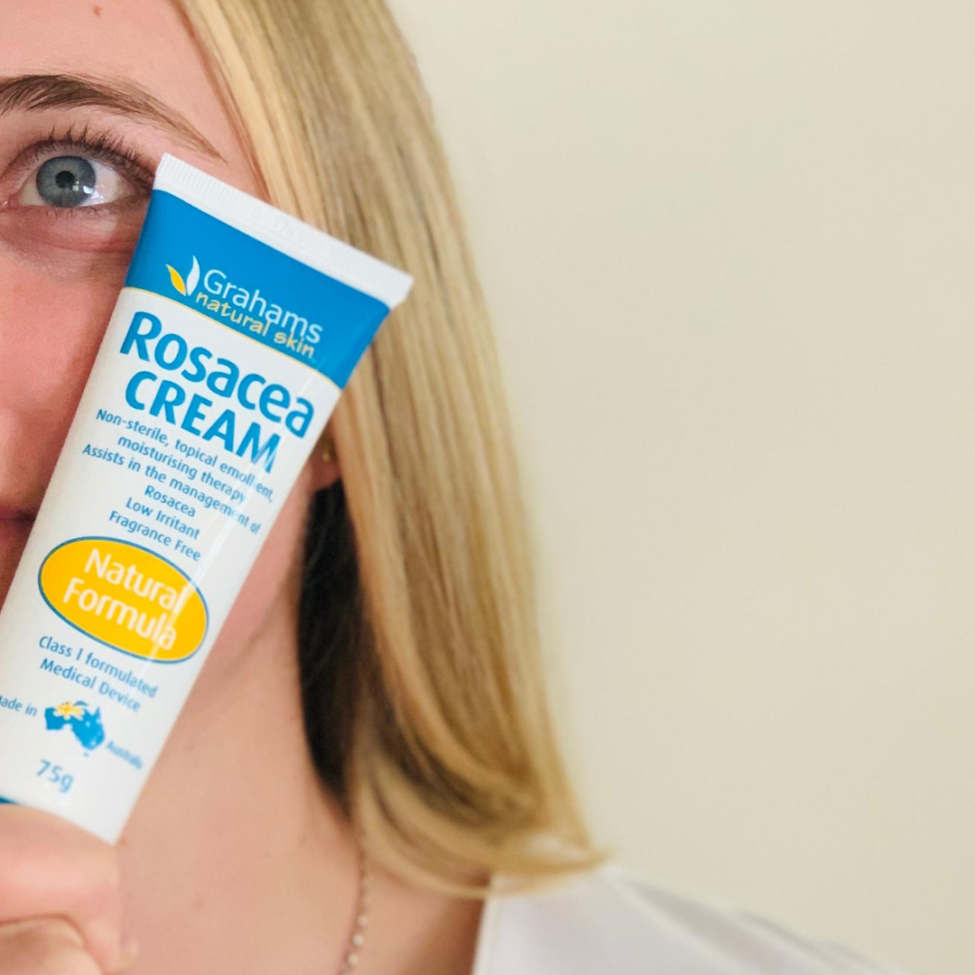 Why everyone is talking about this Rosacea Cream