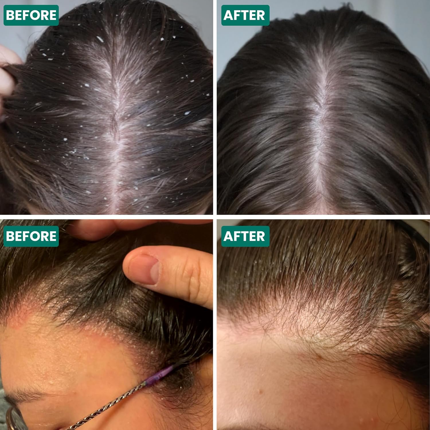 Scalp Relief Shampoo