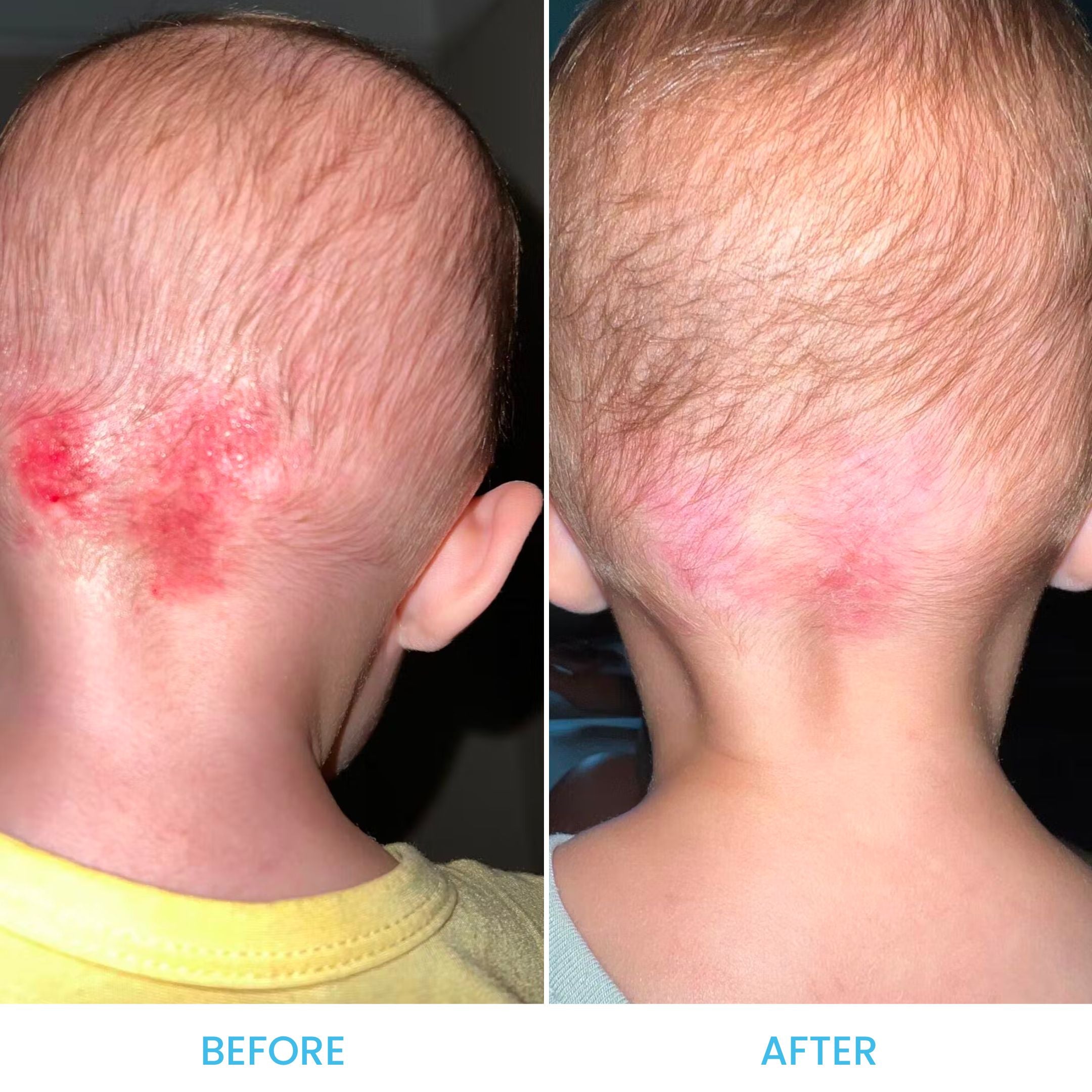 Baby Eczema Cream Grahams Natural Grahams Natural UK