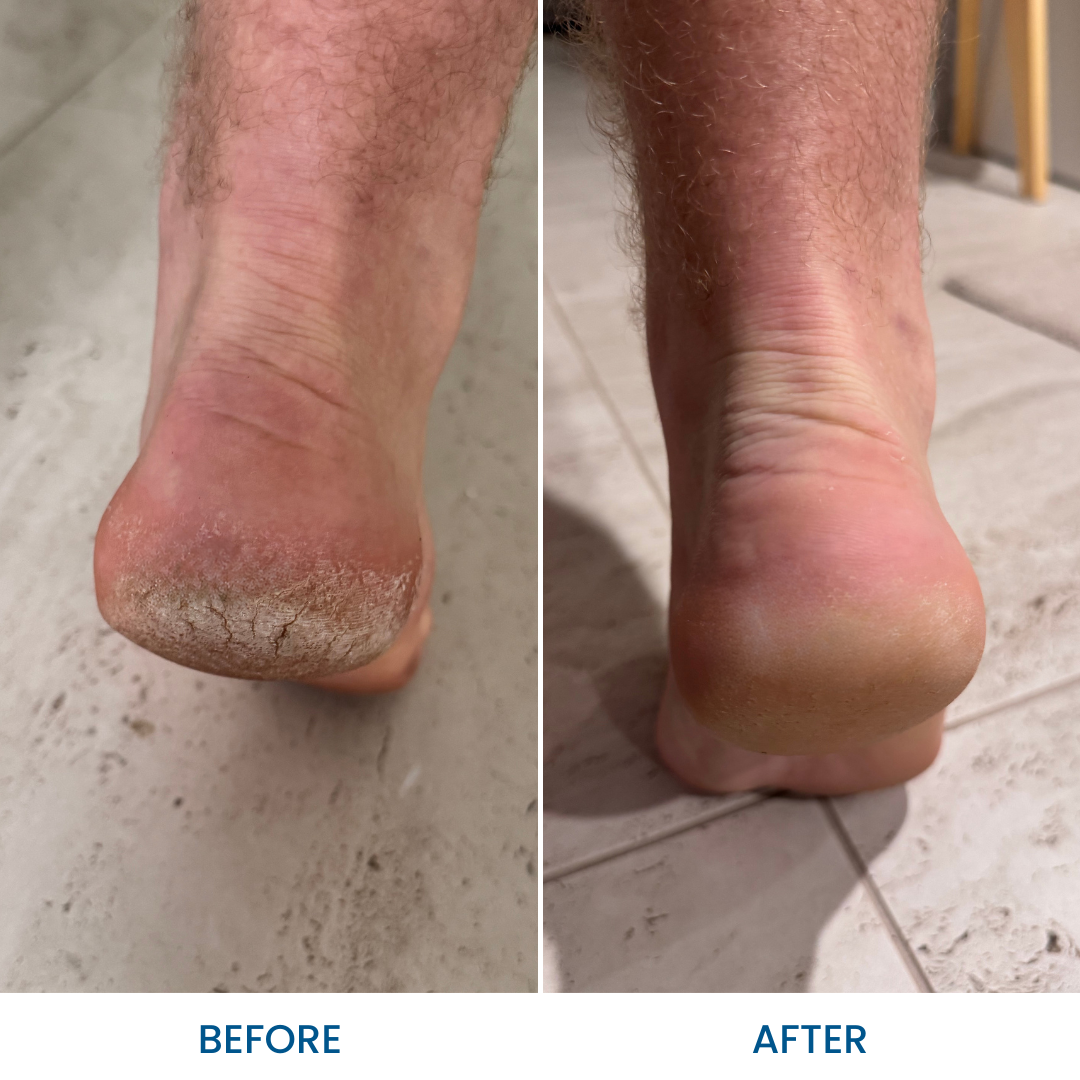 Foot & Heel Cream